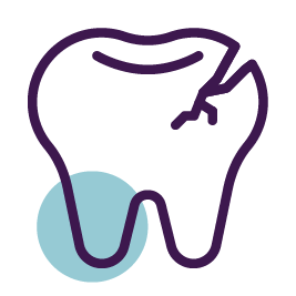 Trauma dentoalveolar - Lesión en los dientes