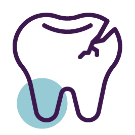 Trauma dentoalveolar - Lesión en los dientes